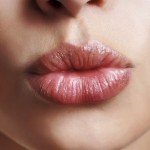 Treat Chapped Lips