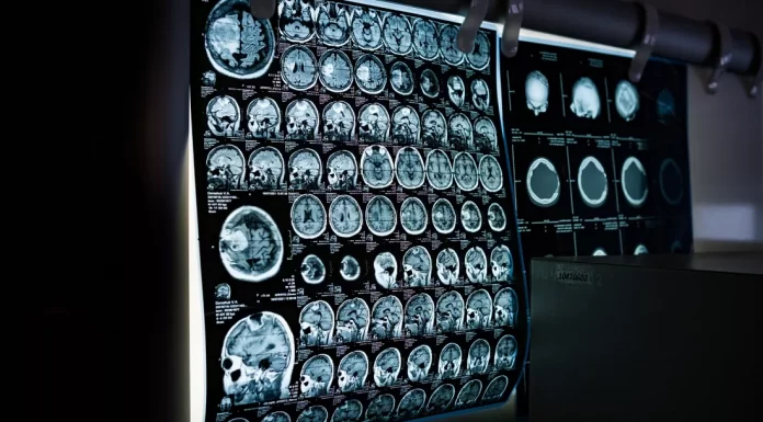 This German tech company’s new MRI could save lives by detecting cancer earlier