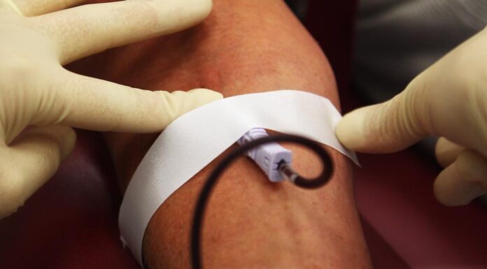 US to ease blood donation rules for gay men