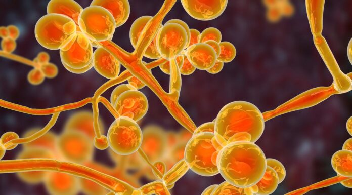 ‘Worrisome’ deadly fungus spreading through US at alarming rate