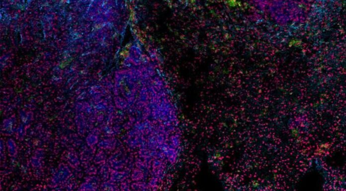 Ancient viruses in human DNA help fight cancer, scientists say