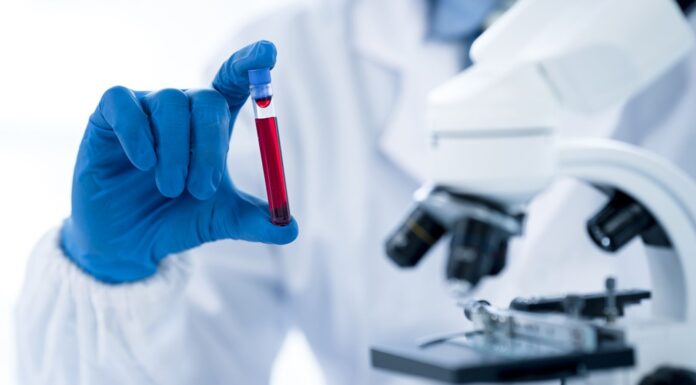 Multi-cancer blood test could ‘help save thousands of lives’ by speeding up diagnosis, study suggests